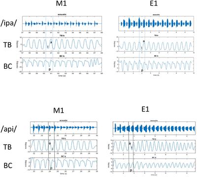 Speech Kinematics and Coordination Measured With an MEG-Compatible Speech Tracking System